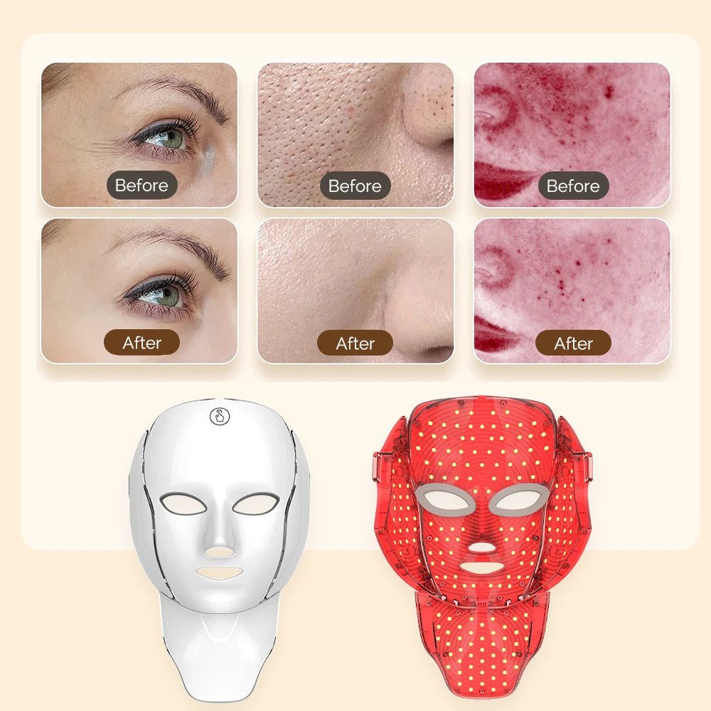 Rejuvenate LED Light Therapy Mask